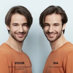 Nioxin System 2Natural Hair Progressed Thinning Scalp & Hair Treatment -Verzinnen Zorg Winkel lw8sJg234528 7 dgl NL
